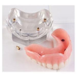 Over-Denture Locator Model ULOC-4 Upper Ea