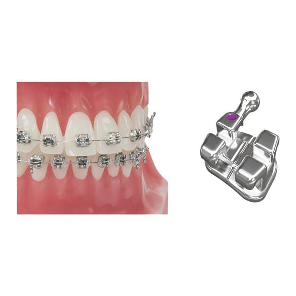 MBT Bracket 0.022 in LL5 10/Pk