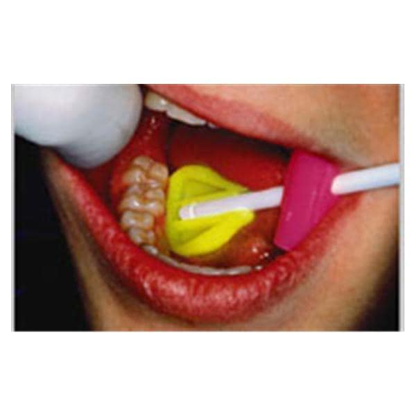 Dentapops Saliva Ejectors Multicolor Bx